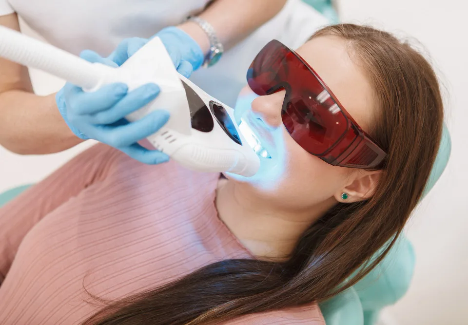 teeth whitening