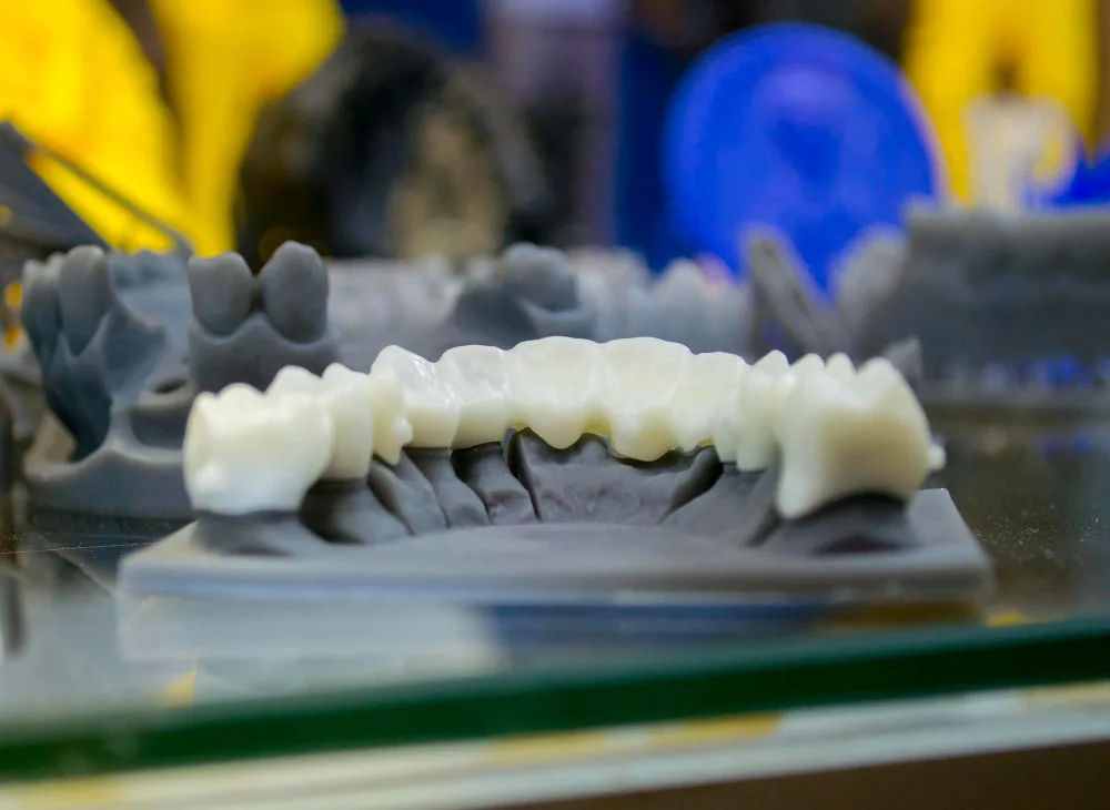 3D Printing Dentistry img 4