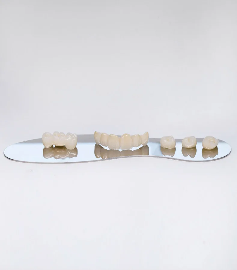 Dental Bridges img 2