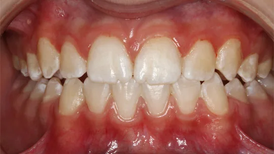Patient IC after