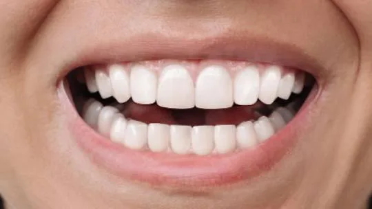 denture implant after