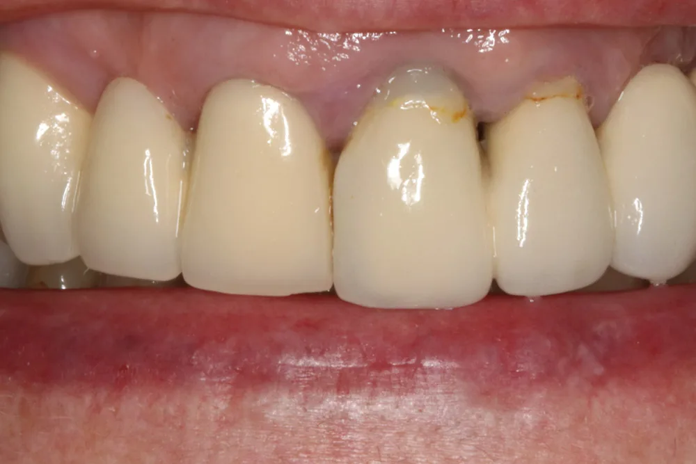 JSk before