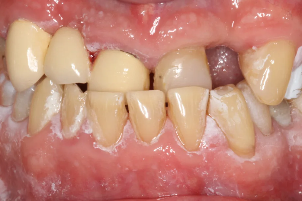 psk before