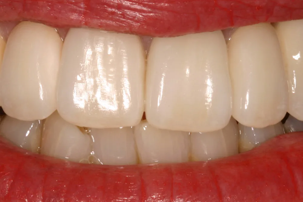 rw after