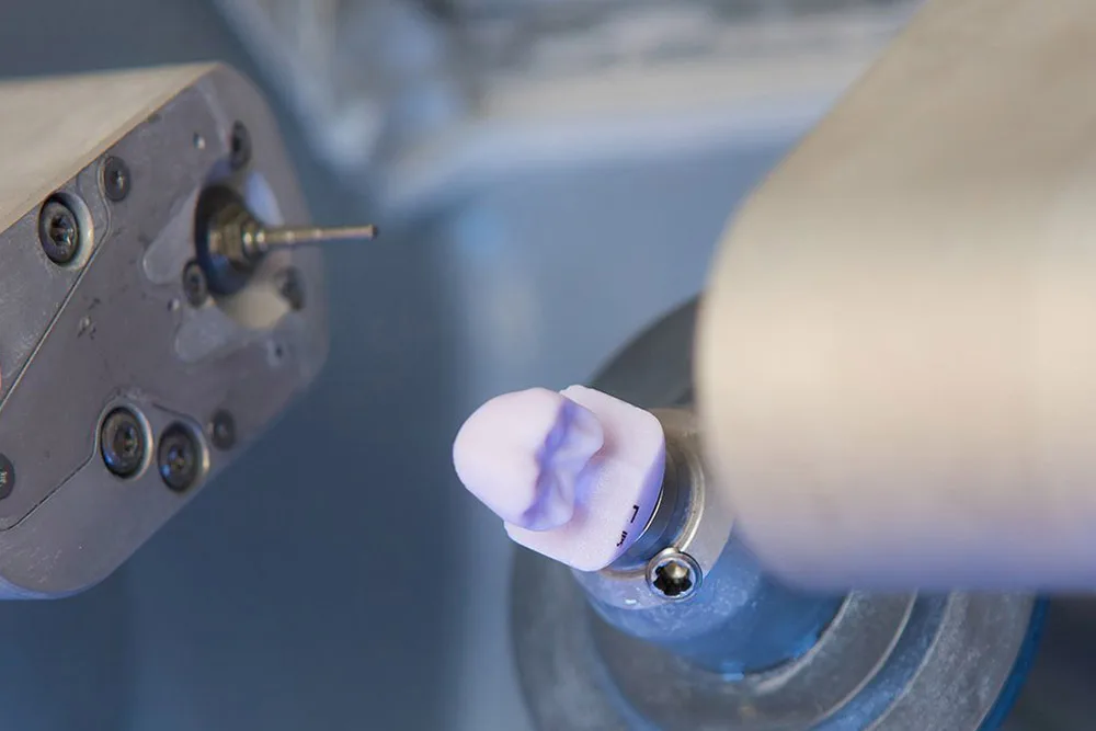 same day cerec crown