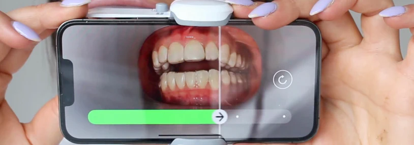 remote dental monitoring