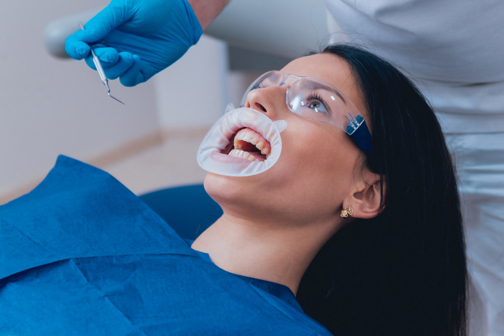 teeth bleaching