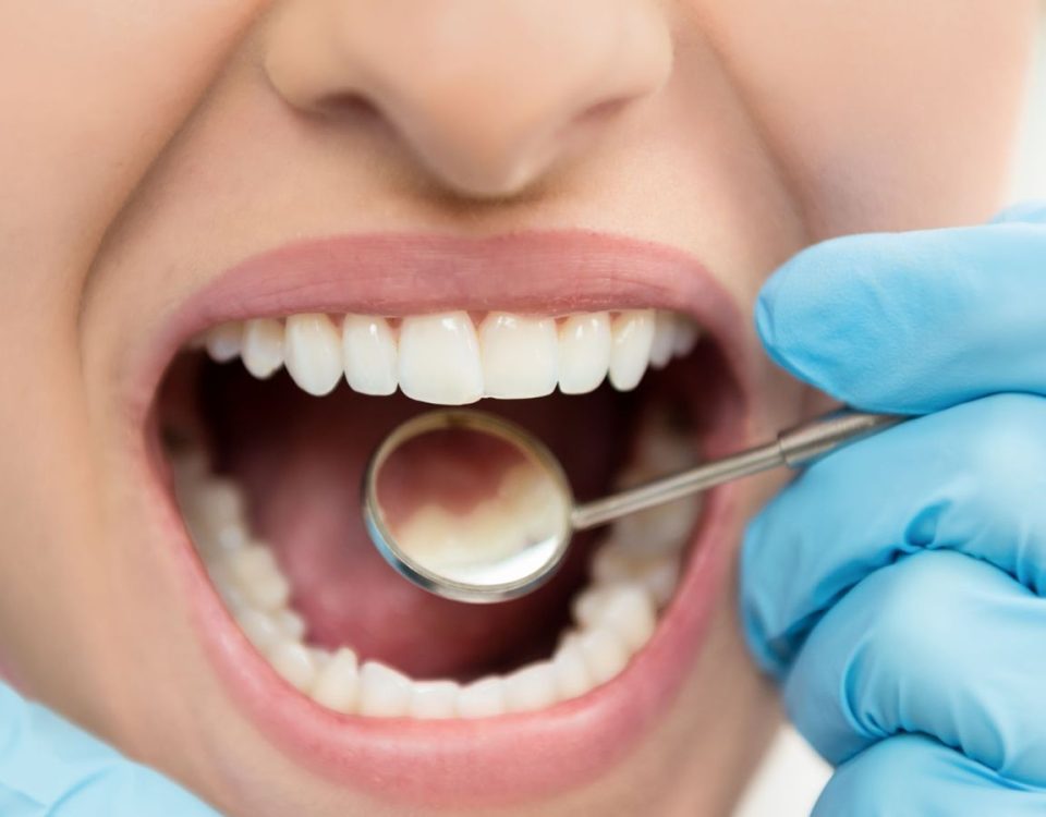 How Much Does Teeth Cleaning Cost 1